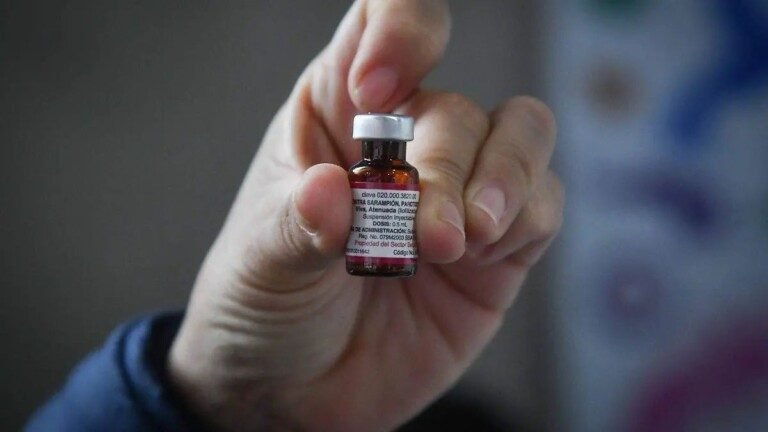 Sarampión avanza en México: más de 8 mil casos confirmados y 27 defunciones en lo que va del brote, la infancia la más afectada